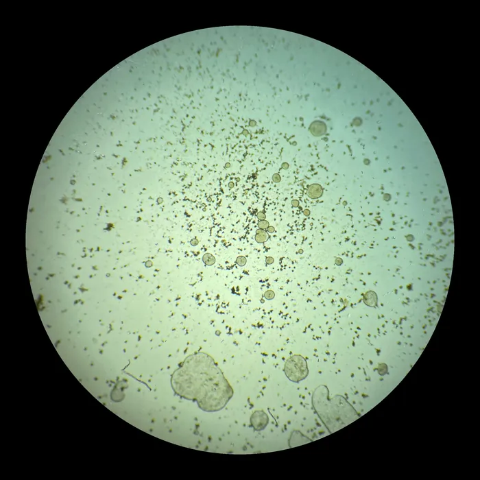 Through the microscope: a pale green field dotted with particles