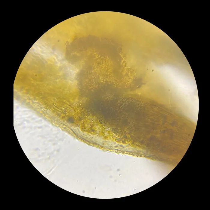 Through the microscope: a golden edge crossing the field