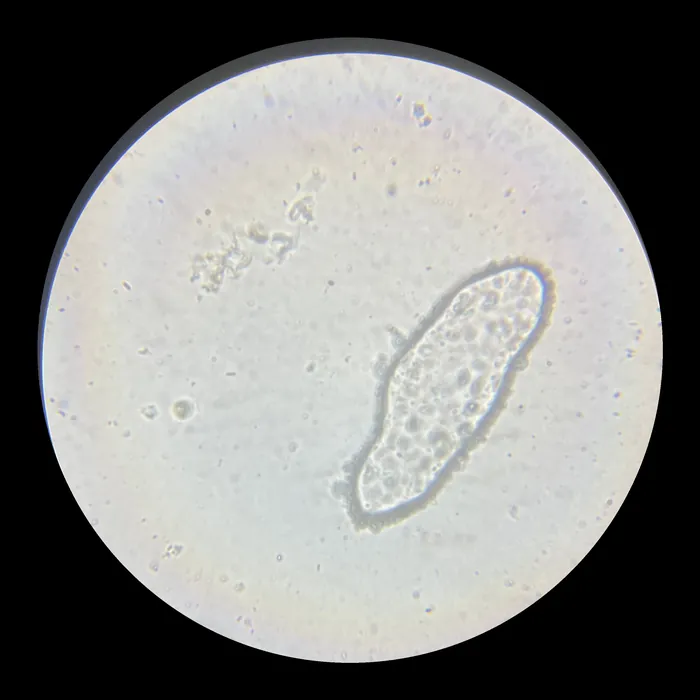 Through the microscope: a single oval cell on a pale field
