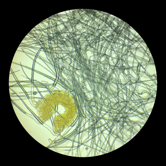 Through the microscope: green-grey threads crossing