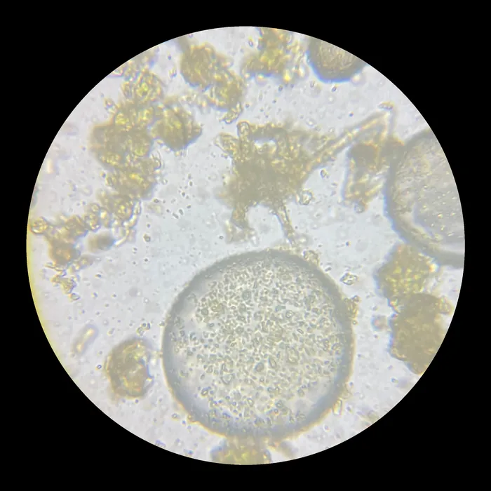 Through the microscope: a round cluster among scattered particles
