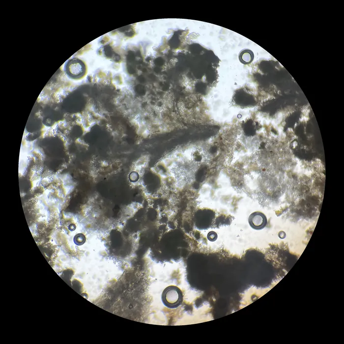Through the microscope: dark particles in soil