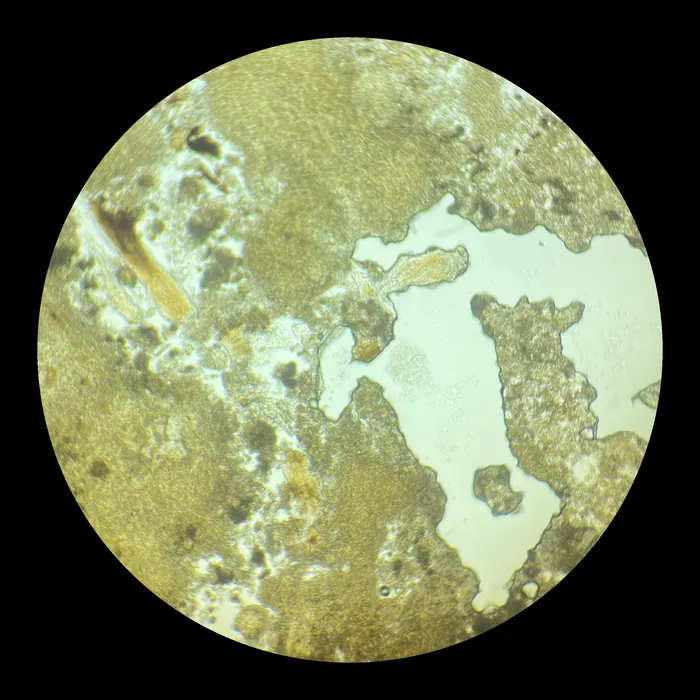 Through the microscope: yellow-green tissue
