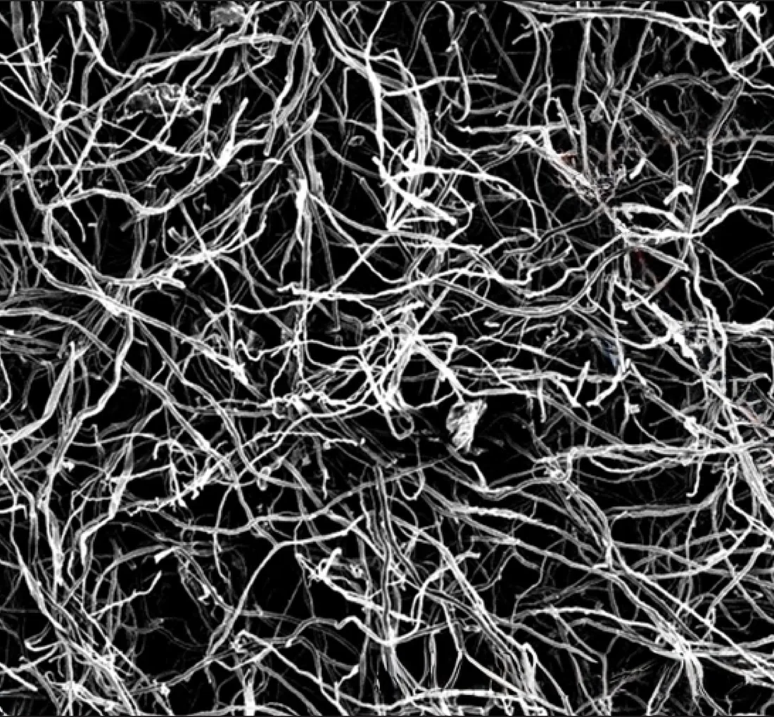 Electron microscope image of white fungal threads crossing in a dense web on black